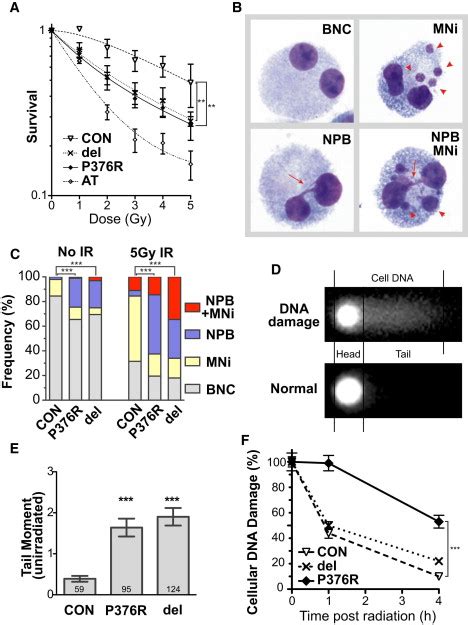 Rad Mutations Cause A Human Cohesinopathy The American Journal Of