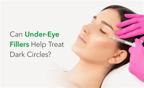 Can Under Eye Fillers Help Treat Dark Circles Synergy Wellness