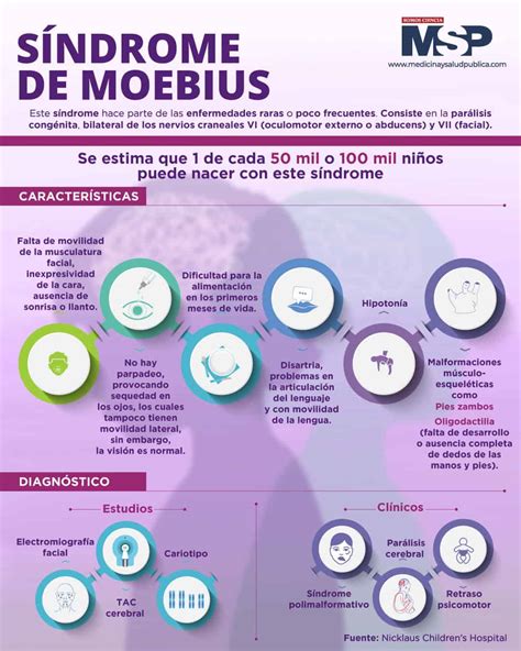 Síndrome de Moebius Infografía