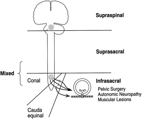 Anatomic Classification Of The Neurogenic Bladder From Cardenas DD