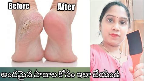 Pedicure At Home కాళ్లు పగుళ్లు తగ్గాలంటే ఇలా చేయండి How To Do