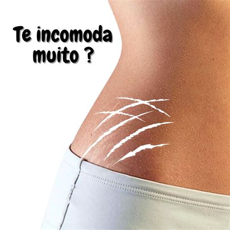 Que tal remover suas estrias em até 99 Estrias Remoção de estrias