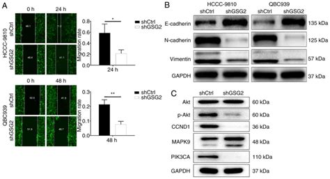 Gsg Knockdown Suppresses Cholangiocarcinoma Progression By Regulating