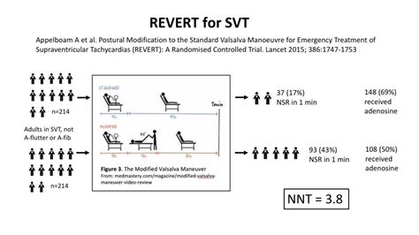 Revert For Svt Pem Source