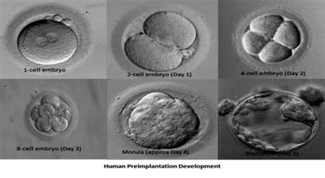 Day 3 vs. Day 5 Embryo Transfers