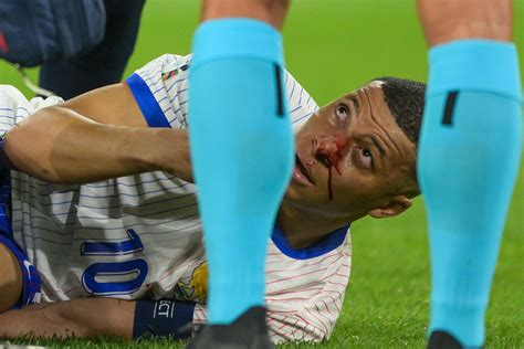 Perch A Kylian Mbappe Sar Vietato Indossare La Sua Speciale Maschera