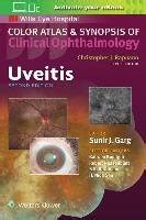 Uveitis Color Atlas And Synopsis Of Clinical Ophthalmology Garg