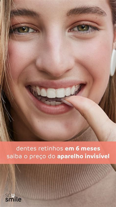 Aparelho Transparente Alinhe Seus Dentes De Maneira Discreta Artofit