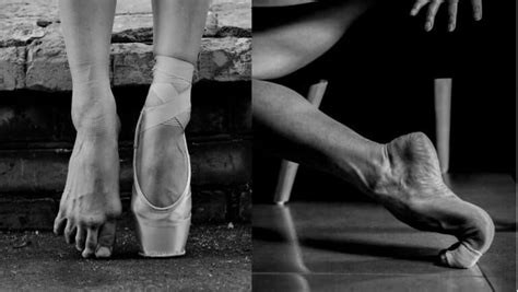 Ballerina Feet - Conditions that cause Ballerina Feet Damage