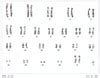 23 Chromosomes - Functions and Types of Chromosomes - GeeksforGeeks