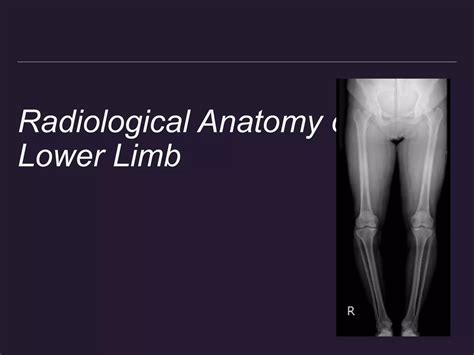 Radiological Anatomy Of Lower Limb Ppt