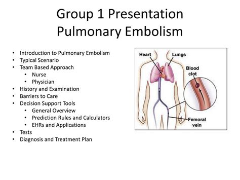 Ppt Group 1 Presentation Pulmonary Embolism Powerpoint Presentation Free Download Id 2219088