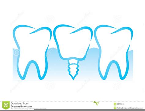 Dental Implant Clipart Free Images At Clker Vector Clip Art