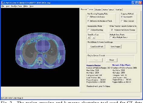 Figure 1 From Ultra Low Dose Ct Attenuation Correction Maps For