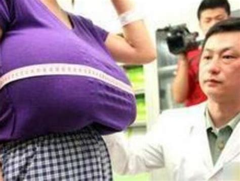 10岁女童患上巨乳症原因在哪里？中医是这么看的