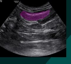 Diagnostic Imaging Of The Urogenital Tract Flashcards Quizlet