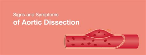 Aortic Dissection Causes Symptoms Treatments