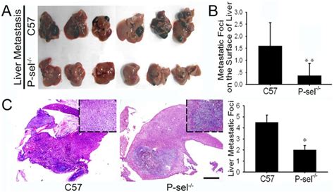 A Gross Anatomy Of The B16 Liver Metastases In C57 And P Sel− − Mice