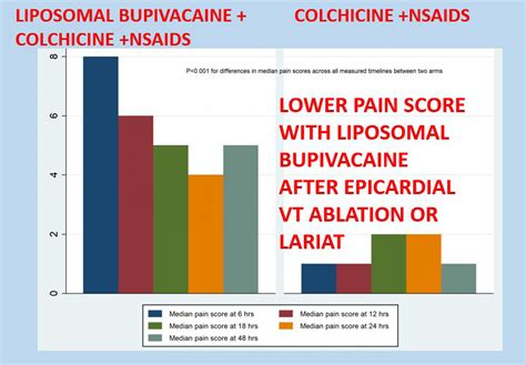 Epicardial Interventions Impact Of Liposomal Bupivacaine On