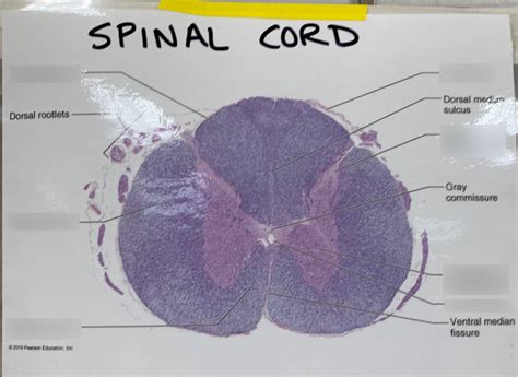 Lab Practical 3 Spinal Cord Microscope Label Diagram Quizlet