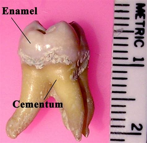 Tooth enamel - Wikipedia | Tooth enamel, Teeth bleaching, Teeth