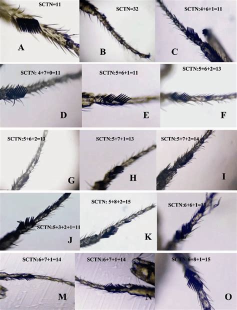 B Teeth Arrangement Patterns In Three Drosophila Species A D