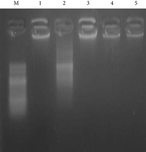 An Agarose Gel Electrophoresis Image Shows Dna Fragmentation Lane M