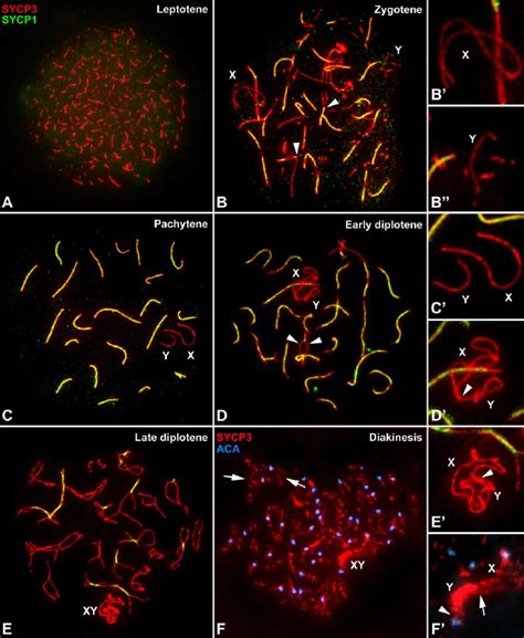 Immunolabeling Of Spread Spermatocytes With Anti SYCP3 Red And