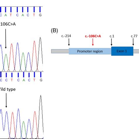 Genomic Position Of The C 106C A Variant In The OTC Gene A Sanger