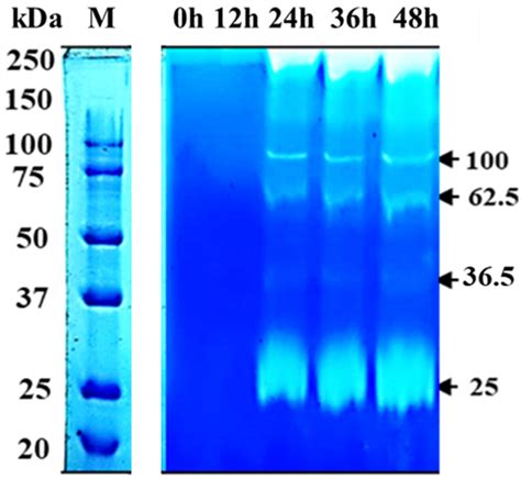 Keratinase Zymogram Showing NCIM 5802 Keratinase During The Course Of