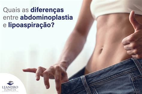 Quais As Diferen As Entre Abdominoplastia E Lipoaspira O Guia Sa De