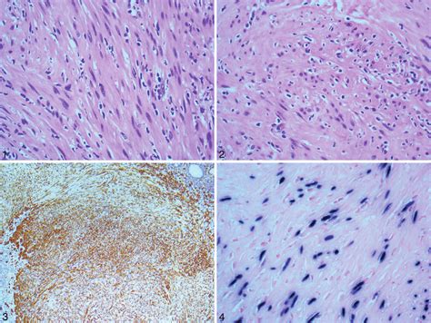 Epstein Barrencoded Rna In Situ Hybridization Highlights The Presence Download Scientific