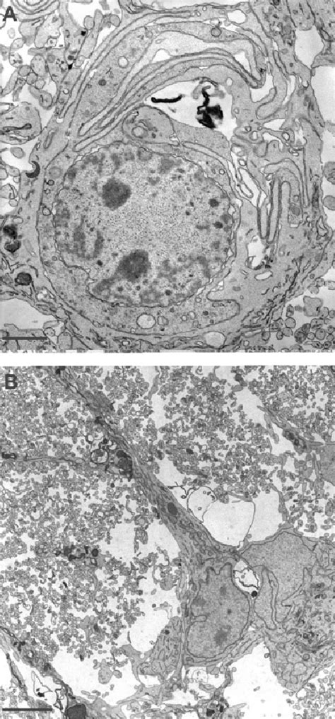 Caspase Staining Of Control A And Axotomized B Retinal