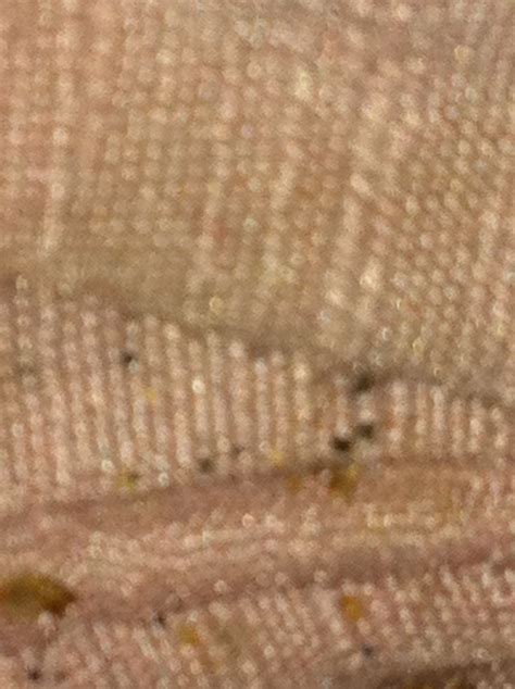 Bed Bugs In Sofa