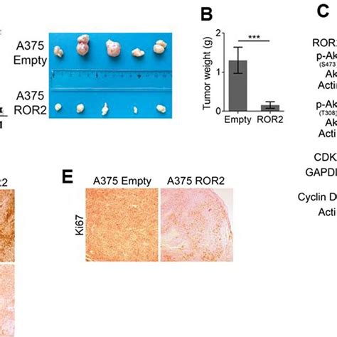 ROR2 Inhibits Tumor Growth In Vivo A ROR2 Expression Inhibits Tumor