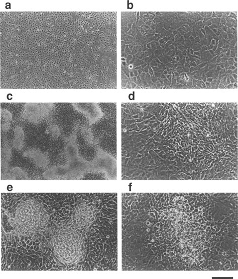 Phase Contrast Micrographs Of Atdc5 Cells Cells Were Cultured In