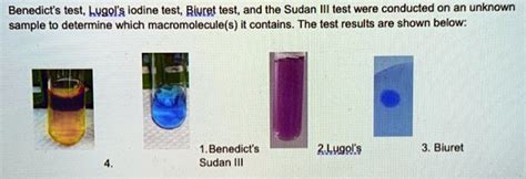 SOLVED Benedicts Test Lugol S Iodine Test Biuret Test And The Sudan