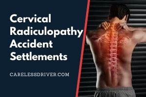 What Is The Typical Settlement For Cervical Radiculopathy Spetsas Hot