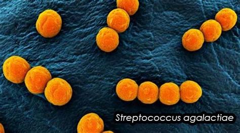 Biochemical Test Of Streptococcus Agalactiae