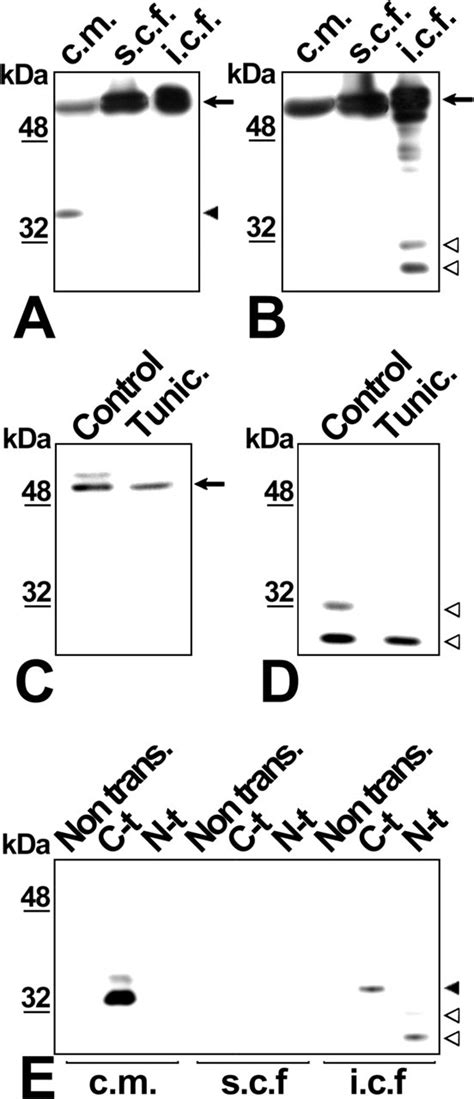 Characterization Of The Intracellular Proteolytic Cleavage Of Myocilin