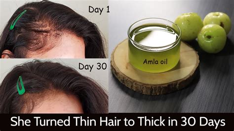 My Mom Turned Her Thin Hair To Thick Hair In 30 Days Amla Hair Oil For Hair Growth And Long Hair