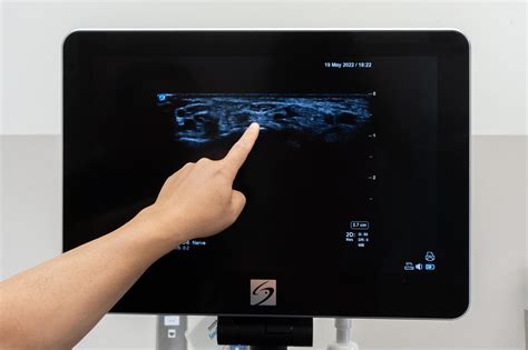 ultrasound  mri top  reasons ultrasound    option