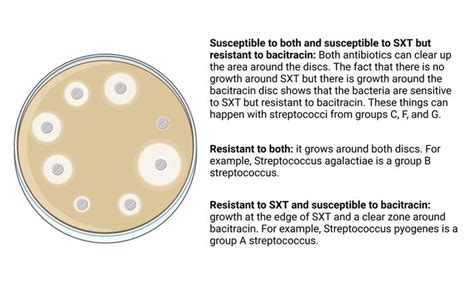 SXT Test Principle Procedure Result Streptococcus Agalactiae Group