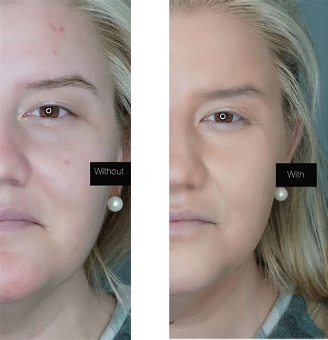 How To Color Correct Undereye Circles Redness And Blemishes With