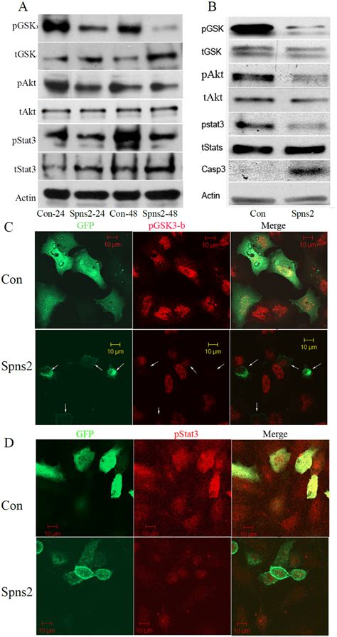 Spns Expression Induces Apoptosis By Down Regulating Pro Survival