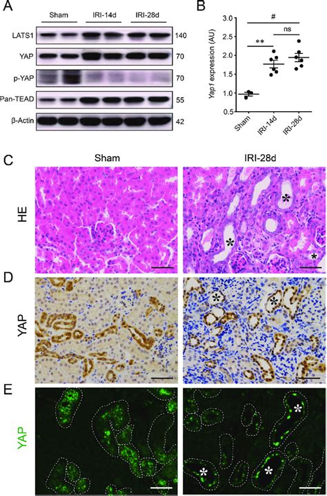 Renal Persistent Activation Hippo YAP Pathway In Response To