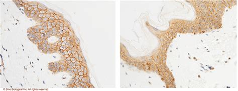 Beta Catenin Antibody Guideline Preparation Dilution And Applications