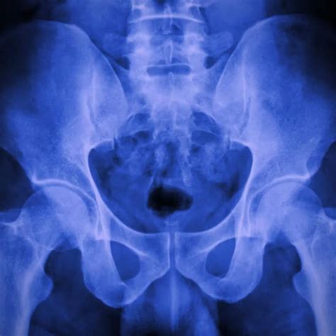 Chase Icon STREAM TIGHT PUSSY SYNDROME BY CAELATURA NIGGER Lyrics And Tracklist Genius