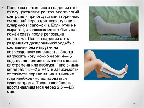 Повреждение голеностопного сустава - презентация онлайн