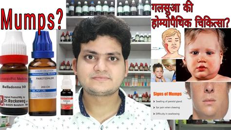 Mumps गलसुआ Homeopathic Medicine For Mumps Explain Youtube